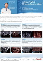 microV in MSK Ultrasound examination