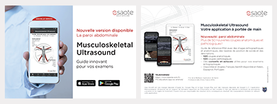 Application Musculoskeletal Ultrasound