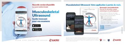 Application Musculoskeletal Ultrasound