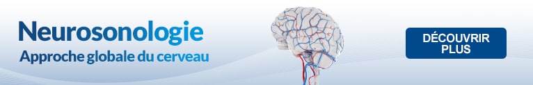 Neurosonologie - Approche globale du cerveau