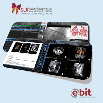 Discover SUITESTENSA RIS CVIS PACS Healthcare IT integrated Diagnostic Imaging Software platform