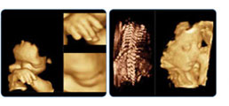 X4D Obstetrics