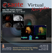 Virtual Navigator & Fusion Imaging