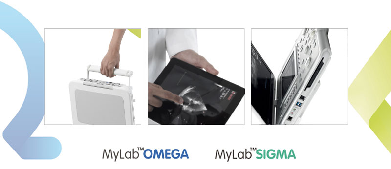 Discover the new MyLab<sup>™</sup>Omega and MyLab<sup>™</sup>Sigma portable ultrasound systems