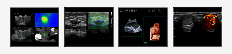 Learn more about MyLab<sup>™</sup>9 Clinical Images