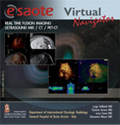 Virtual Navigator & Fusion Imaging