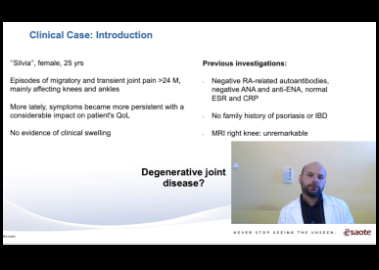 The value of very high-frequency probes in the diagnostic work-up of spondyloarthritis