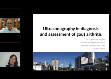 Ultrasonagraphy in diagnosis and assessment of gout arthritis