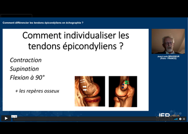 JFR 2021-WEBINAIRE MSK