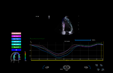 Xstrain2D