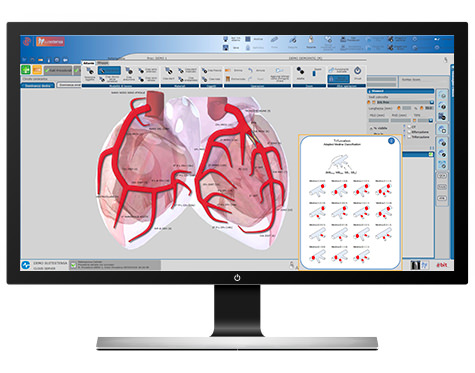 SUITESTENSA Cathlab