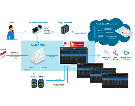 Suitestensa Remote Cardiac Device Management