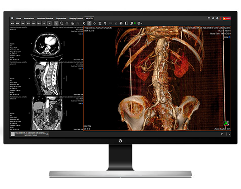 SUITESTENSA Enterprise Viewer