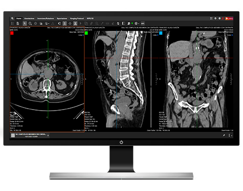 SUITESTENSA Enterprise Viewer