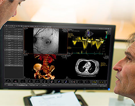 SUITESTENSA UniViewer