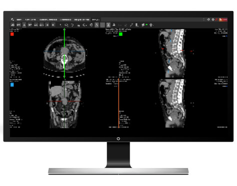 SUITESTENSA UniViewer