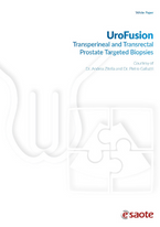 UroFusion Transperineal and Transrectal Prostate Targeted Biopsies