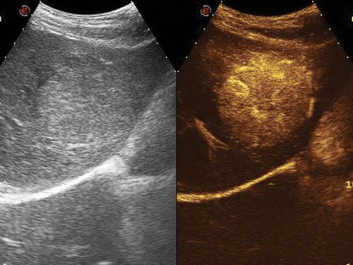 CnTI<sup>™</sup> Contrast Tuned Imaging