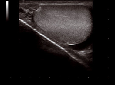 Clinical Image - MyLab<sup>™</sup>Twice - Testicle (VPan Imaging)