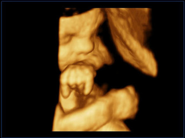 Clinical Image - MyLab<sup>™</sup>Seven - Baby Face (X4D Imaging)