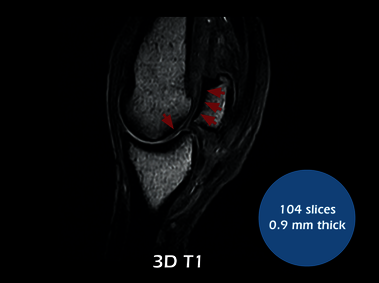 Clinical Image - O-scan equine: Fetlock Arthropathy