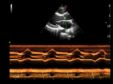 Image clinique - MyLab<sup>™</sup>Alpha - Cœur (Imagerie CMM)
