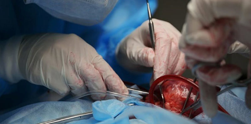 Suitestensa Cardio Surgery