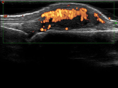 Clinical Image - MyLab<sup>™</sup>Twice - Finger