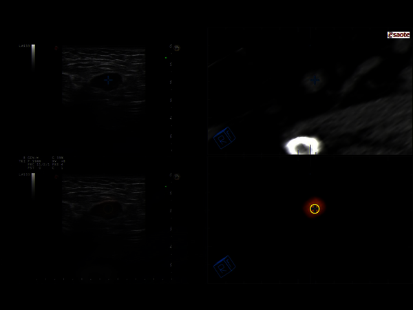 Clinical Image - MyLab™Eight eXP - Lesion detection in ginecology with multiparametric approach