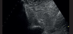 Clinical Image - MyLab™EightVET - Spine B-Mode