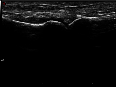 Clinical Image - MyLab<sup>™</sup>Seven - Right Foot