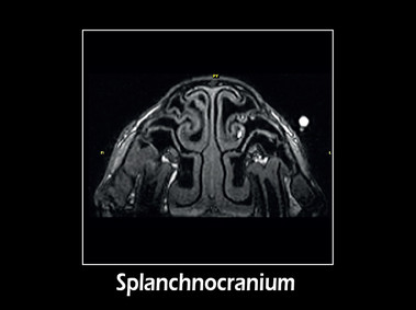 Clinical Image - G-scan equine: Splacno