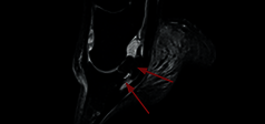 Clinical Image - O-scan equine: Lesion of the collateral ligaments of the coffin joint
