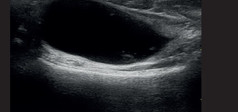 Clinical Image - MyLab™EightVET - MSK B-Mode