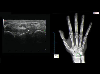 Clinical Image - MyLab<sup>™</sup>Eight Platform - BodyMap with X-Ray