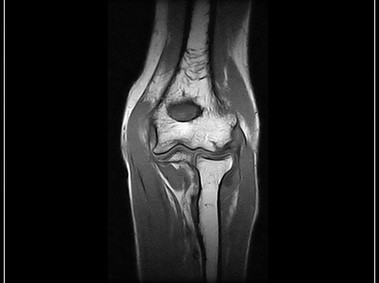 G-scan Brio - Elbow - SE T1 Sagittal