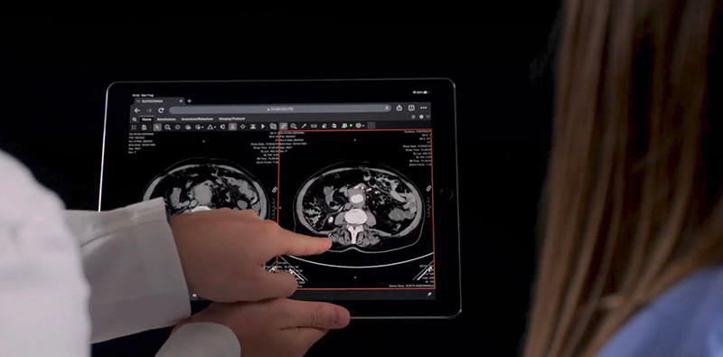 Suitestensa UniViewer