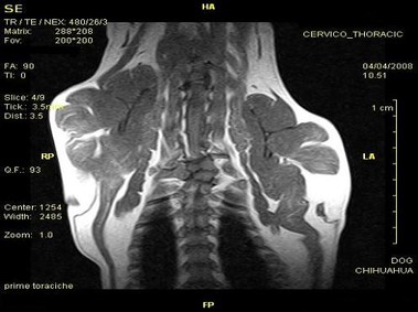 Clinical Image - Vet-MR - Cervo-thoracic - SE T1 weighted dorsal