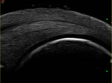 Clinical Image - MyLab<sup>™</sup>Twice - Bone Cartilage Tendon
