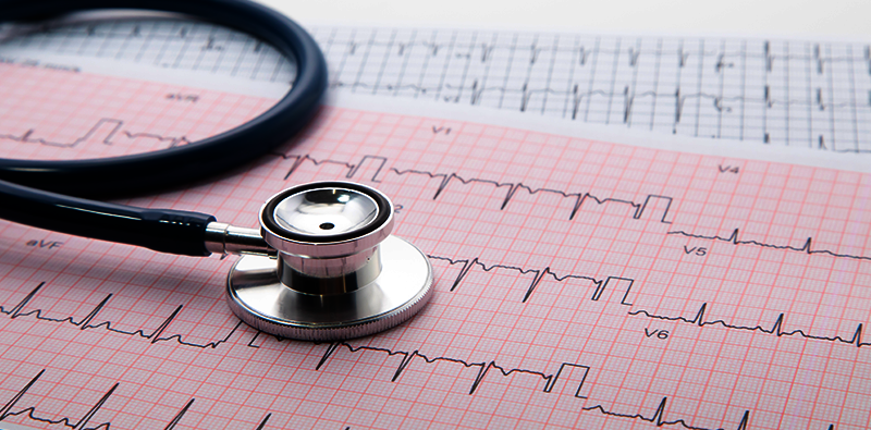 Suitestensa ECG