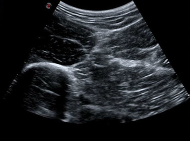 Clinical Image - MyLab<sup>™</sup>Seven - Regional anaesthesia and pain management, Deep nerves