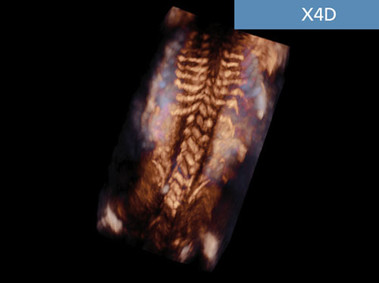 Clinical Image - MyLab<sup>™</sup>Seven - X4D Imaging