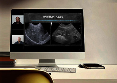 Liver ultrasonographic study in dogs and cat