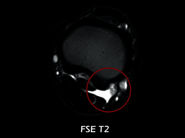 Clinical Image - O-scan equine: Fetlock Arthropathy