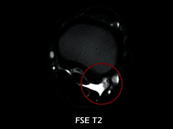 Clinical Image - O-scan equine: Fetlock Arthropathy