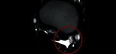 Clinical Image - O-scan equine: Fetlock Arthropathy