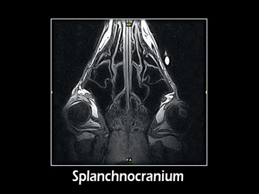 Clinical Image - G-scan equine: Splacno