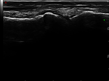 Clinical Image - MyLab<sup>™</sup>Twice - Right Foot