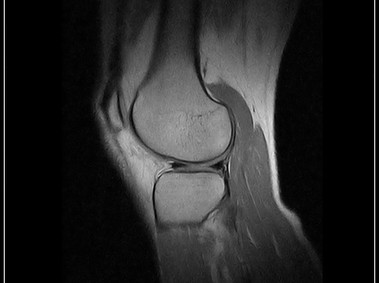 G-scan Brio - Knee - FSE PD Sagittal