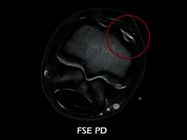 Clinical Image - O-scan equine: Fetlock Arthropathy
